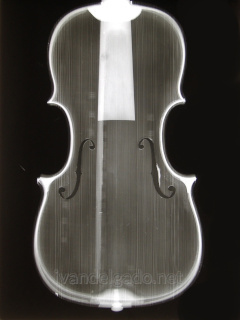 Radiografía de violín
